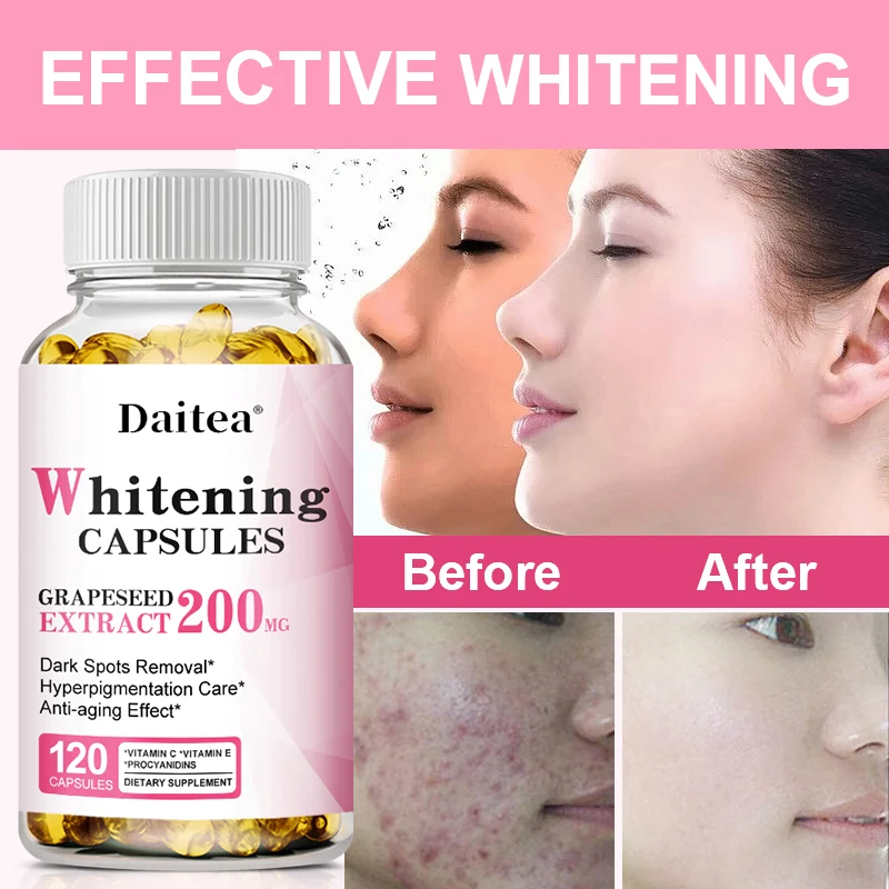 Vitamin E Proanthocyanidins, Grape Seed Extract, Effective Whitening, Dark Spot Removal, Pigment Care, Anti-aging, Smooth Skin
Vitamin E Proanthocyanidins, Grape Seed Extract, Effective Whitening, Dark Spot Removal, Pigment Care, Anti-aging, Smooth Skin