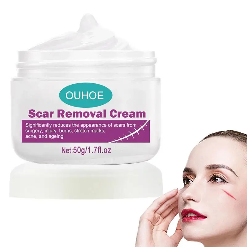 Scar Removal Cream Scar Balm For Stretch Mark Removal Scar Care Treat For Surgical Scars Relief Burns Repair Pimple Spots Fade
Scar Removal Cream Scar Balm For Stretch Mark Removal Scar Care Treat For Surgical Scars Relief Burns Repair Pimple Spots Fade