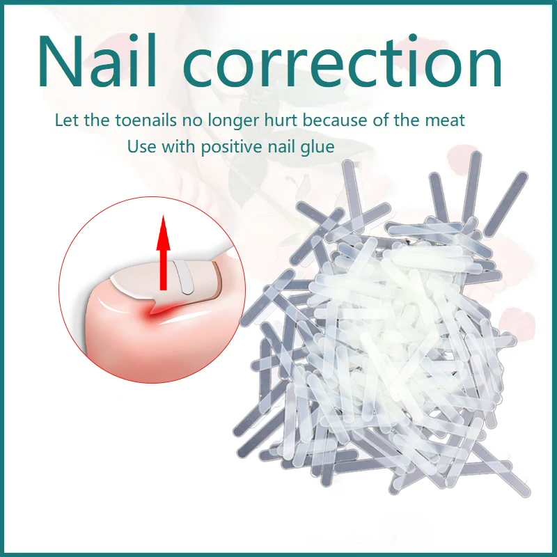 10pcs Ingrown Toe nail Correction Tool Toe Nail Treatment Elastic Patch Sticker Straightening Clip Brace Pedicure Tool New
10pcs Ingrown Toe nail Correction Tool Toe Nail Treatment Elastic Patch Sticker Straightening Clip Brace Pedicure Tool New