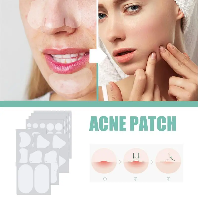

Acne Mask Patch Face Acne Pimple Spot Scar Care Treatment Stickers Facial Skin Care Blackhead Removal Freckle Patches Acne Mask
