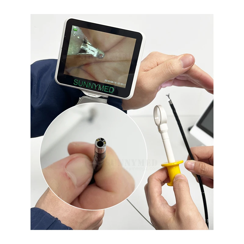 Sunnymed P029-3 New Competitive Surgical Endoscopic Device ENT Video Endoscope Price
Sunnymed P029-3 New Competitive Surgical Endoscopic Device ENT Video Endoscope Price