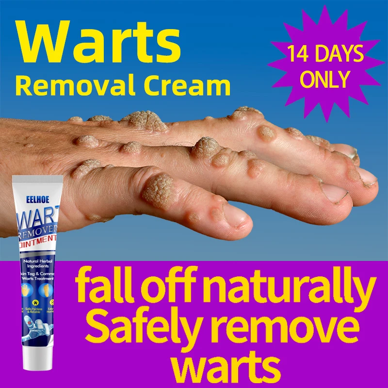 Skin Tag Removal Cream Flat Wart Genital Warts Filiform Wart Plantar Wart Remover Cream
Skin Tag Removal Cream Flat Wart Genital Warts Filiform Wart Plantar Wart Remover Cream
