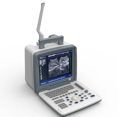 Factory Price China Portable Ultrasound Scanner Pregnancy Diagnosis Black And White Ultrasound Scanner Machine
Factory Price China Portable Ultrasound Scanner Pregnancy Diagnosis Black And White Ultrasound Scanner Machine