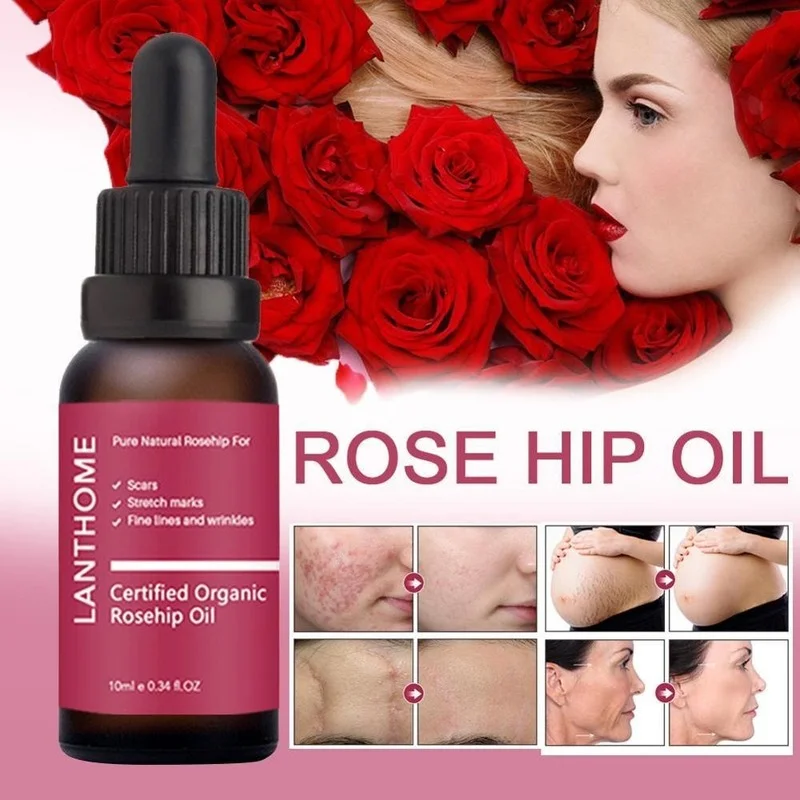 Pure Organic Rosehip Oil Antioxidantfor Scars Fine Lines Wrinkles Stretch Marks Improve Skin Elasticity Firmness
Pure Organic Rosehip Oil Antioxidantfor Scars Fine Lines Wrinkles Stretch Marks Improve Skin Elasticity Firmness