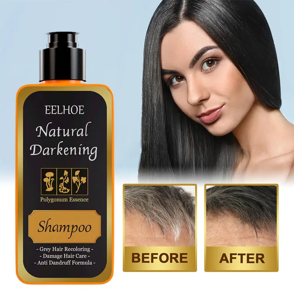 Шампунь для ухода за волосами против выпадения волос Sh G0I0, 200 мл 
Шампунь для ухода за волосами против выпадения волос Sh G0I0, 200 мл