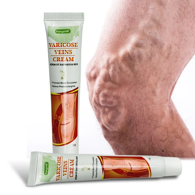20g Varicose Veins Cream Cure Varicocele Ointment Scrotum Varicosity Vasculitis Veined treatment Cream Medical Plaster
20g Varicose Veins Cream Cure Varicocele Ointment Scrotum Varicosity Vasculitis Veined treatment Cream Medical Plaster