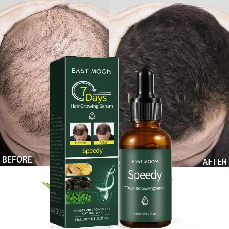 7 Day Hair Growth Essence Fast Growing Anti Hair Loss Products Ginger Beauty Repair Scalp Treatment Natural Care For Men Women
7 Day Hair Growth Essence Fast Growing Anti Hair Loss Products Ginger Beauty Repair Scalp Treatment Natural Care For Men Women