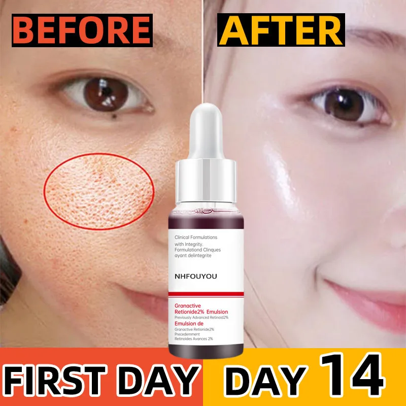 

NHFOUYOU Face Serum Replenishment Moisturize Shrink Pore Brighten Skin Care Firming Facial Contraction Tightens Essence