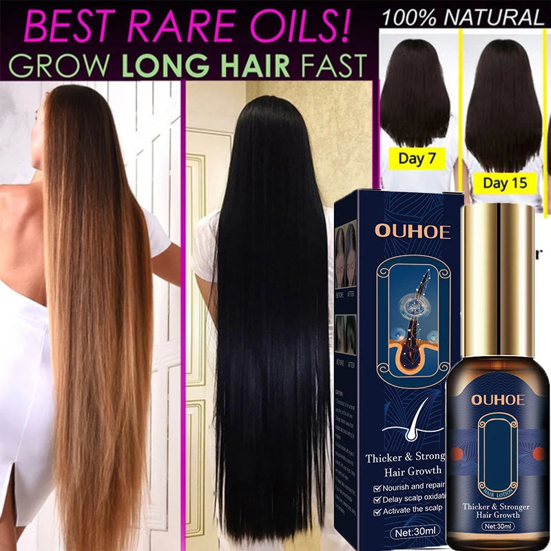 Sdotter Ginger Hair Growth Essential Oil Fast Grow Anti Hair Loss Products Scalp Treatment Dry Frizzy Prevent Baldness Serum Men
Sdotter Ginger Hair Growth Essential Oil Fast Grow Anti Hair Loss Products Scalp Treatment Dry Frizzy Prevent Baldness Serum Men