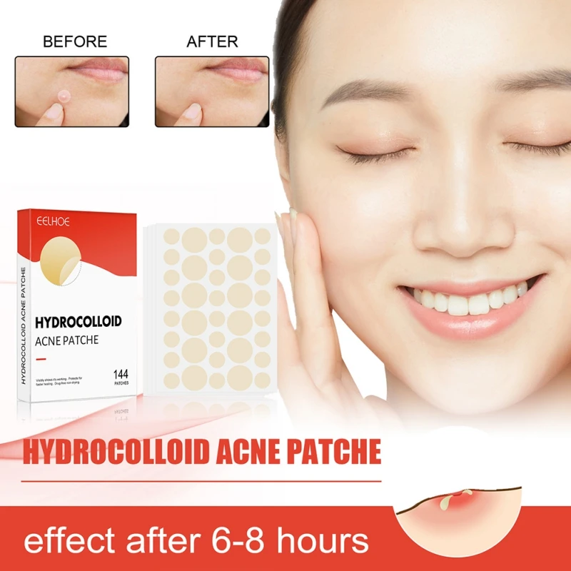 Acne Pimple Patch Spot Treatment Stickers Facial Skin Repair Treatment Skin Care New
Acne Pimple Patch Spot Treatment Stickers Facial Skin Repair Treatment Skin Care New