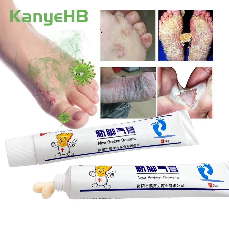 2Pcs Foot Psoriasis Cream Remove Odor Anti Fungal Anti Itch Herbal Athlete's Foot Infection Repair Foot Skin Care Cream A1146
2Pcs Foot Psoriasis Cream Remove Odor Anti Fungal Anti Itch Herbal Athlete's Foot Infection Repair Foot Skin Care Cream A1146