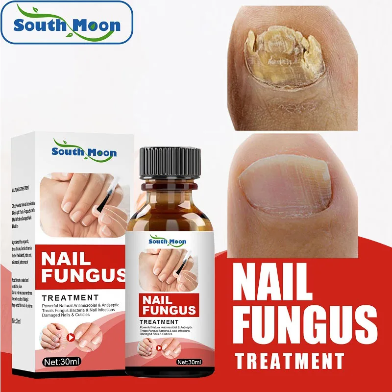 30ml Nail Fungus Serum Fungal Nail Treatment Essence Anti Infection Repair Paronychia Onychomycosis Hand Foot Toe Nail Product
30ml Nail Fungus Serum Fungal Nail Treatment Essence Anti Infection Repair Paronychia Onychomycosis Hand Foot Toe Nail Product