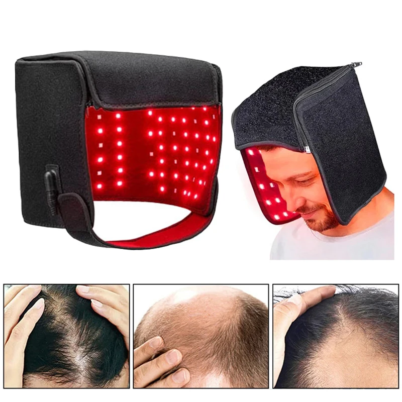 215 LEDs Red Light Therapy Hat For Hair Growth Led Light Helmet For Repair Follicles And Scalp Anti Hair Loss Treatment
215 LEDs Red Light Therapy Hat For Hair Growth Led Light Helmet For Repair Follicles And Scalp Anti Hair Loss Treatment