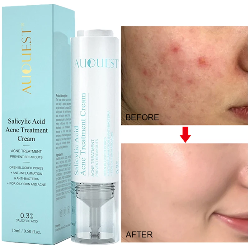 15ml Salicylic Acid Face Serum Acne Treatment Shrink Pores Moisturizing Repairing Oil Control Remove Blackhead Skin Care Essence
15ml Salicylic Acid Face Serum Acne Treatment Shrink Pores Moisturizing Repairing Oil Control Remove Blackhead Skin Care Essence