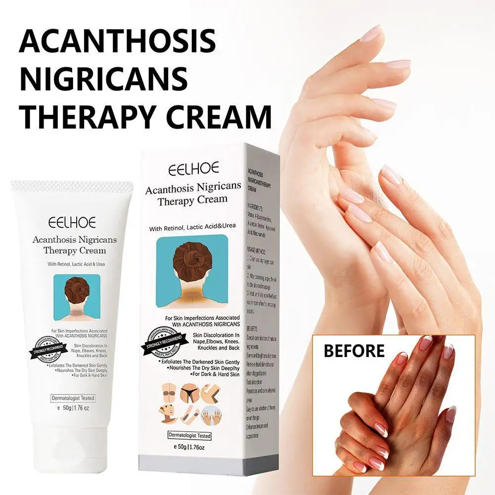 Black Acanthopanax Repair Cream Rejuvenating Firming Whitening Moisturizing Buttock Enlargement Cream For Pain R9P7
Black Acanthopanax Repair Cream Rejuvenating Firming Whitening Moisturizing Buttock Enlargement Cream For Pain R9P7