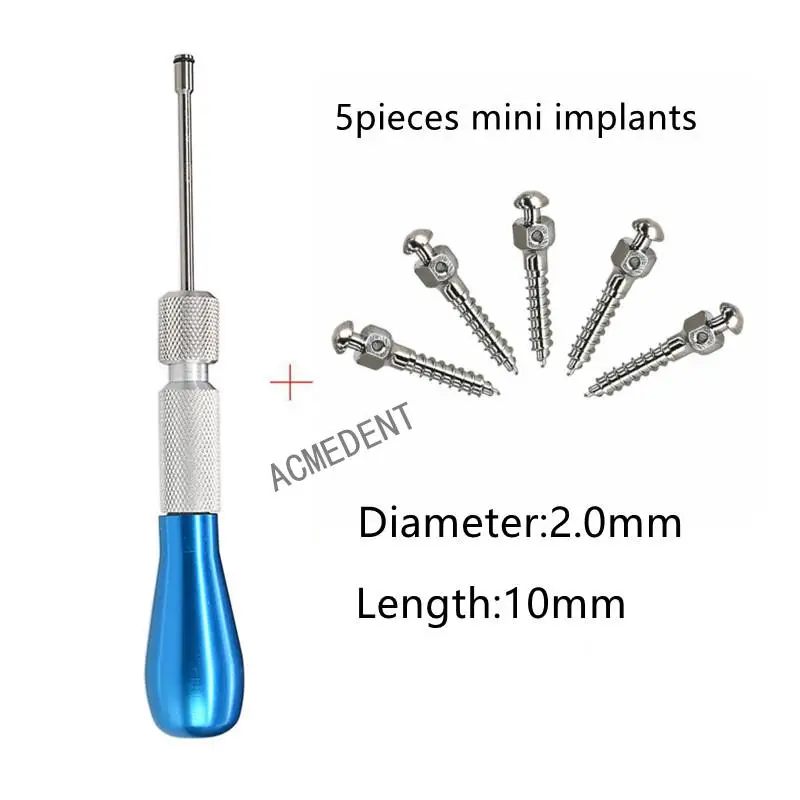 1 Set Screwdriver +5pcs Mini Screws Dental Orthodontic Mini Micro Bone Screws Titanium Screwdriver 2.0mm*10mm
1 Set Screwdriver +5pcs Mini Screws Dental Orthodontic Mini Micro Bone Screws Titanium Screwdriver 2.0mm*10mm