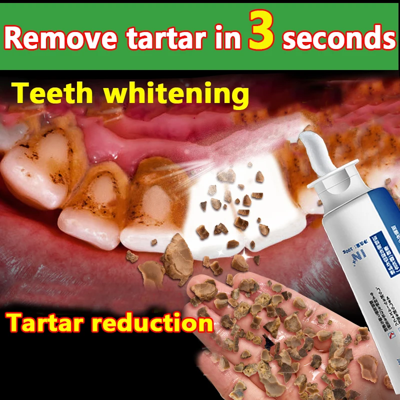 Probiotic Quick Repair of Cavities Caries Filling Removal of Plaque Stains Decay Whitening Yellowing Repair Teeth Whitening
Probiotic Quick Repair of Cavities Caries Filling Removal of Plaque Stains Decay Whitening Yellowing Repair Teeth Whitening