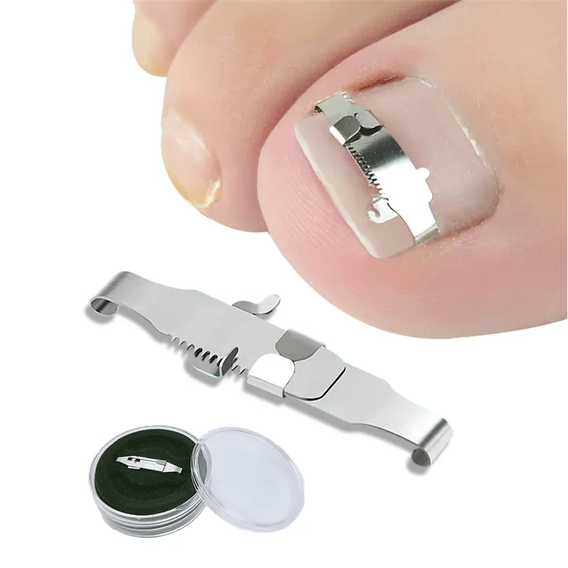2pc Ingrown Toenail Pedicure Foot Tool Embed Paronychia Pedicure Ingrown Toe Nail Correction Feet Care Bunion Corrector Pedicure
2pc Ingrown Toenail Pedicure Foot Tool Embed Paronychia Pedicure Ingrown Toe Nail Correction Feet Care Bunion Corrector Pedicure