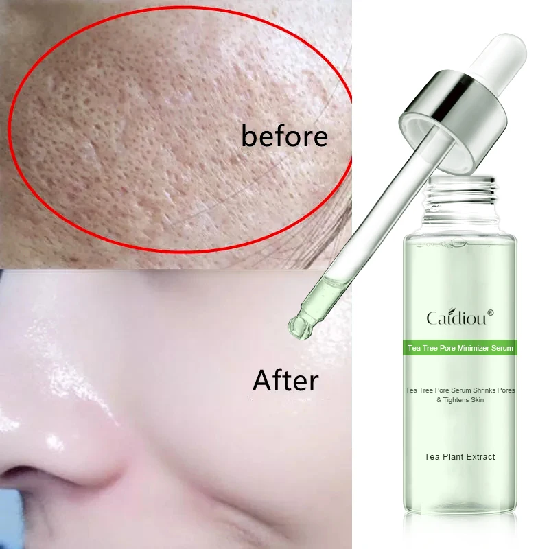 CAIDIOU Pore Refining Serum Shrink Pores Tightens Essence Moisturizing Anti-aging Oil Control 15ml
CAIDIOU Pore Refining Serum Shrink Pores Tightens Essence Moisturizing Anti-aging Oil Control 15ml