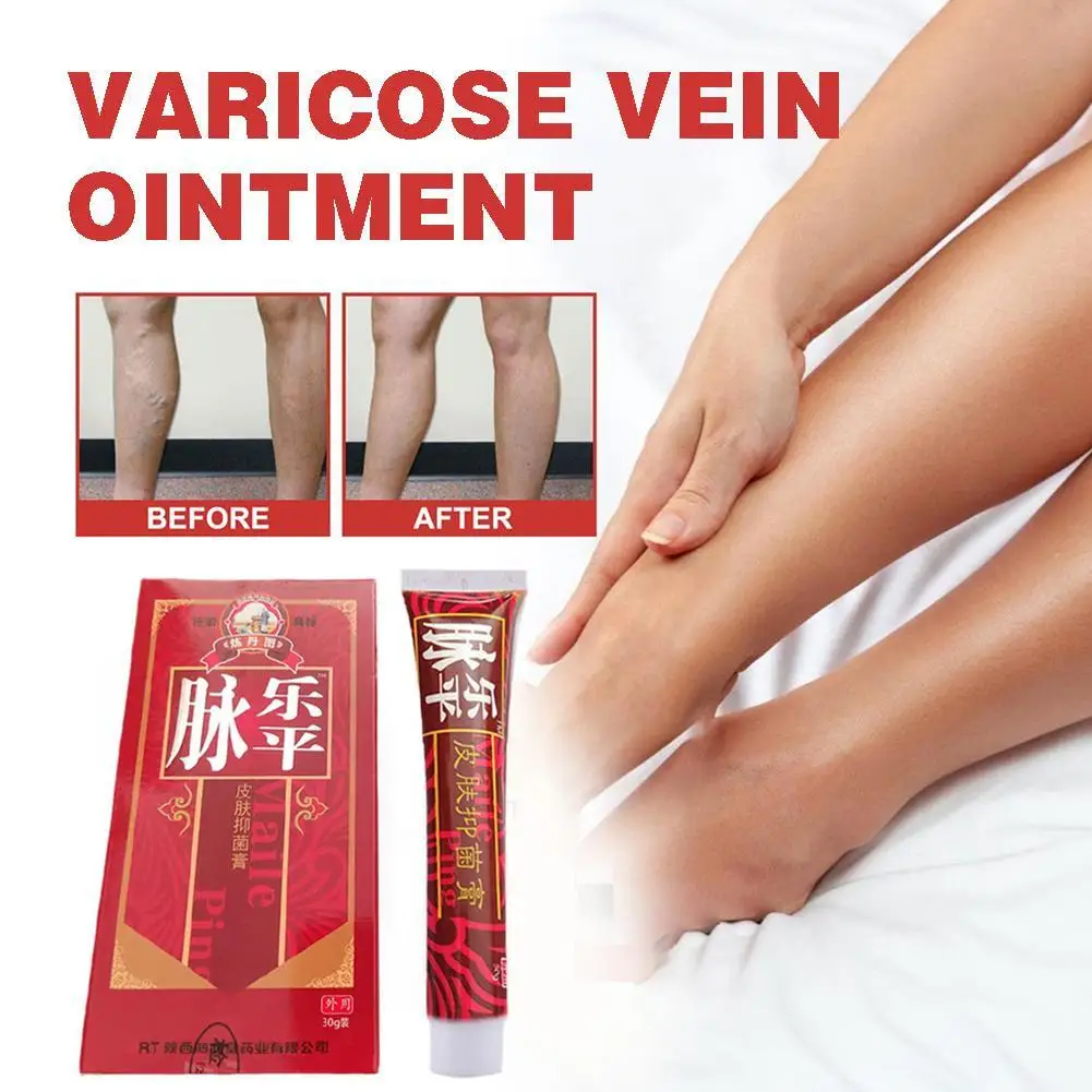 Ointment For Varicose Veins Effective Varicose Vein Relief Cream To Rvasculitis Phlebitis Spider Pain Treatment
Ointment For Varicose Veins Effective Varicose Vein Relief Cream To Rvasculitis Phlebitis Spider Pain Treatment