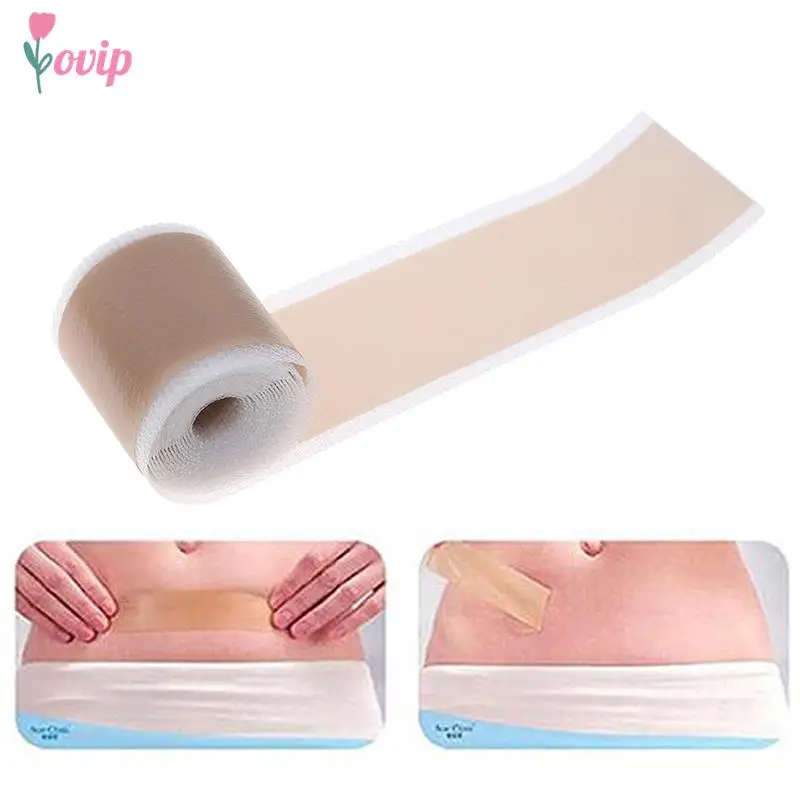 

Efficient Surgery Scar Removal Silicone Gel Sheet Therapy Patch for Acne Trauma Burn Scar Skin Repair Scar Treatment 4x150cm