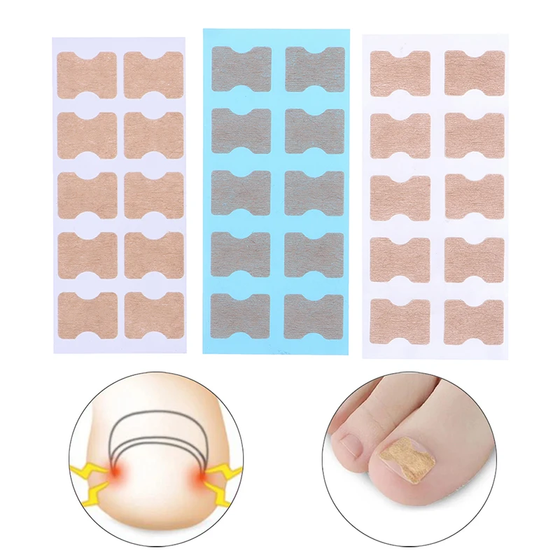 10pcs/sheet Nail Correction Stickers Ingrown Toenail Corrector Patches Pedicure Self-adhesive Ingrown Orthodontic Pads Nail tool
10pcs/sheet Nail Correction Stickers Ingrown Toenail Corrector Patches Pedicure Self-adhesive Ingrown Orthodontic Pads Nail tool