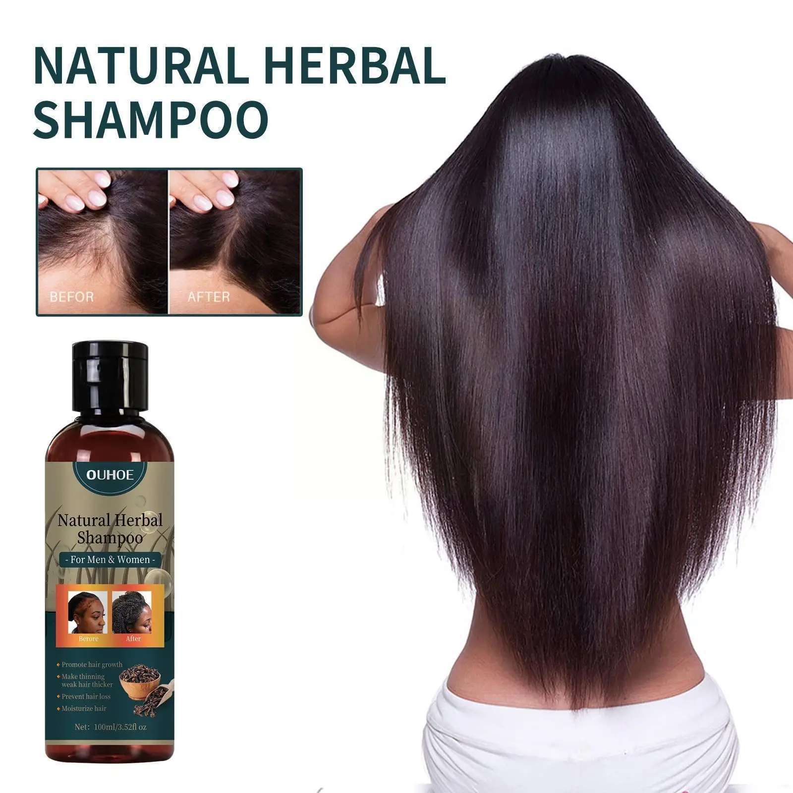 100ml Fast Dense Regrowth Ginger Ingredient Anti Men Serum Treatment Loss Germinal Liquid Essential Oil Women D6Y2 
100ml Fast Dense Regrowth Ginger Ingredient Anti Men Serum Treatment Loss Germinal Liquid Essential Oil Women D6Y2