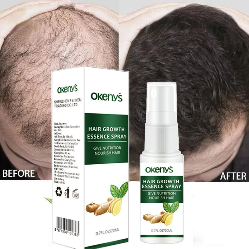Ginger Hair Growth Essential Oil Hair Treatment Serum Anti Lost Beauty Products Fast Grow Repair Scalp Frizzy Damaged Hair Care
Ginger Hair Growth Essential Oil Hair Treatment Serum Anti Lost Beauty Products Fast Grow Repair Scalp Frizzy Damaged Hair Care