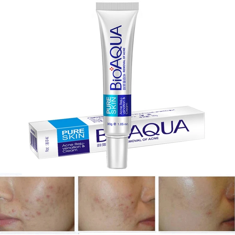 Face Skin Care Acne Treatment Removal Cream Spots Scar Blemish Mark Moisturizing Skin Care
Face Skin Care Acne Treatment Removal Cream Spots Scar Blemish Mark Moisturizing Skin Care