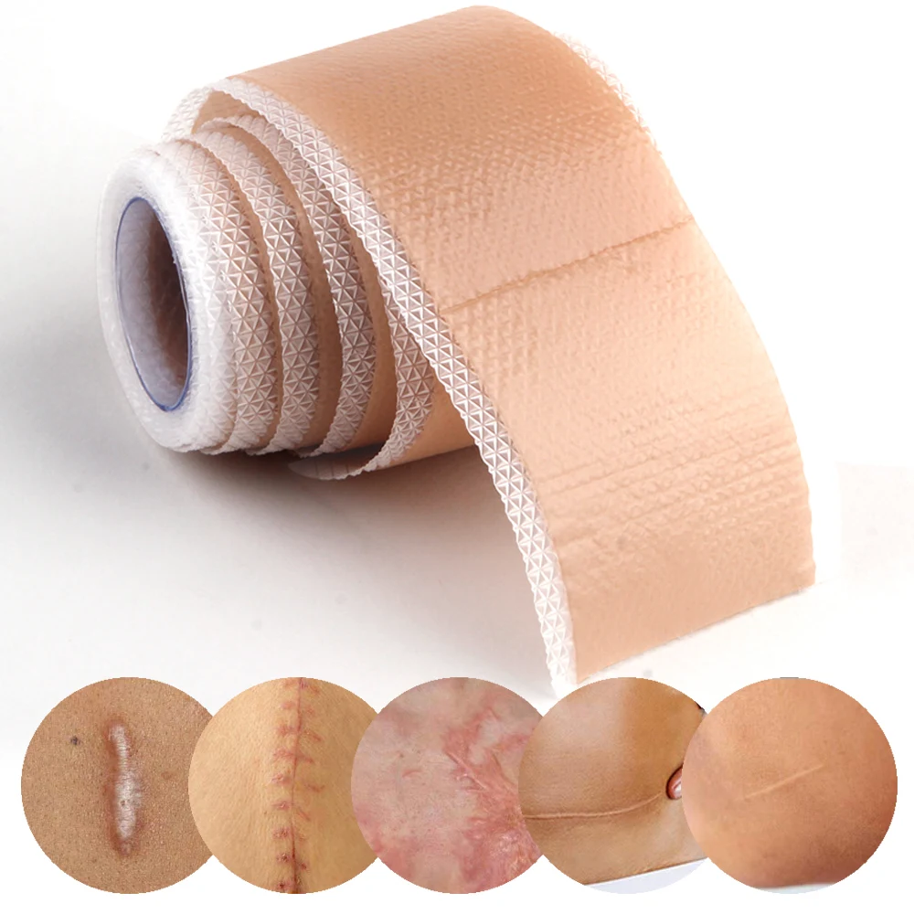 4x50cm Silicone Gel Patch Removal Scar Stickers Medical Treatment Sheet Tape Efficient Surgery Skin Repair Acne Trauma Burn Scar 
4x50cm Silicone Gel Patch Removal Scar Stickers Medical Treatment Sheet Tape Efficient Surgery Skin Repair Acne Trauma Burn Scar