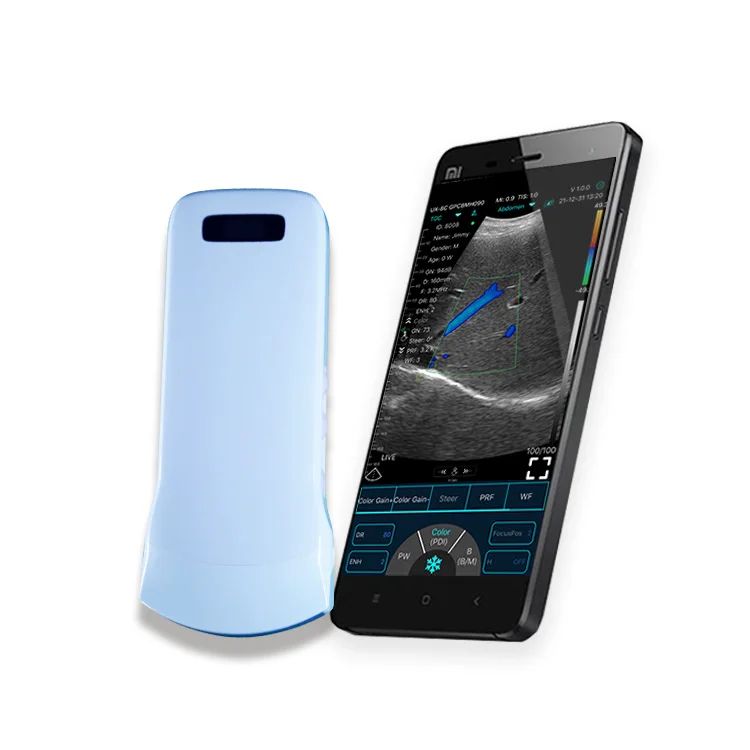 2021 hot sale portable and hand held wireless 192e clinic ultrasound scanning for emergency surgery
2021 hot sale portable and hand held wireless 192e clinic ultrasound scanning for emergency surgery
