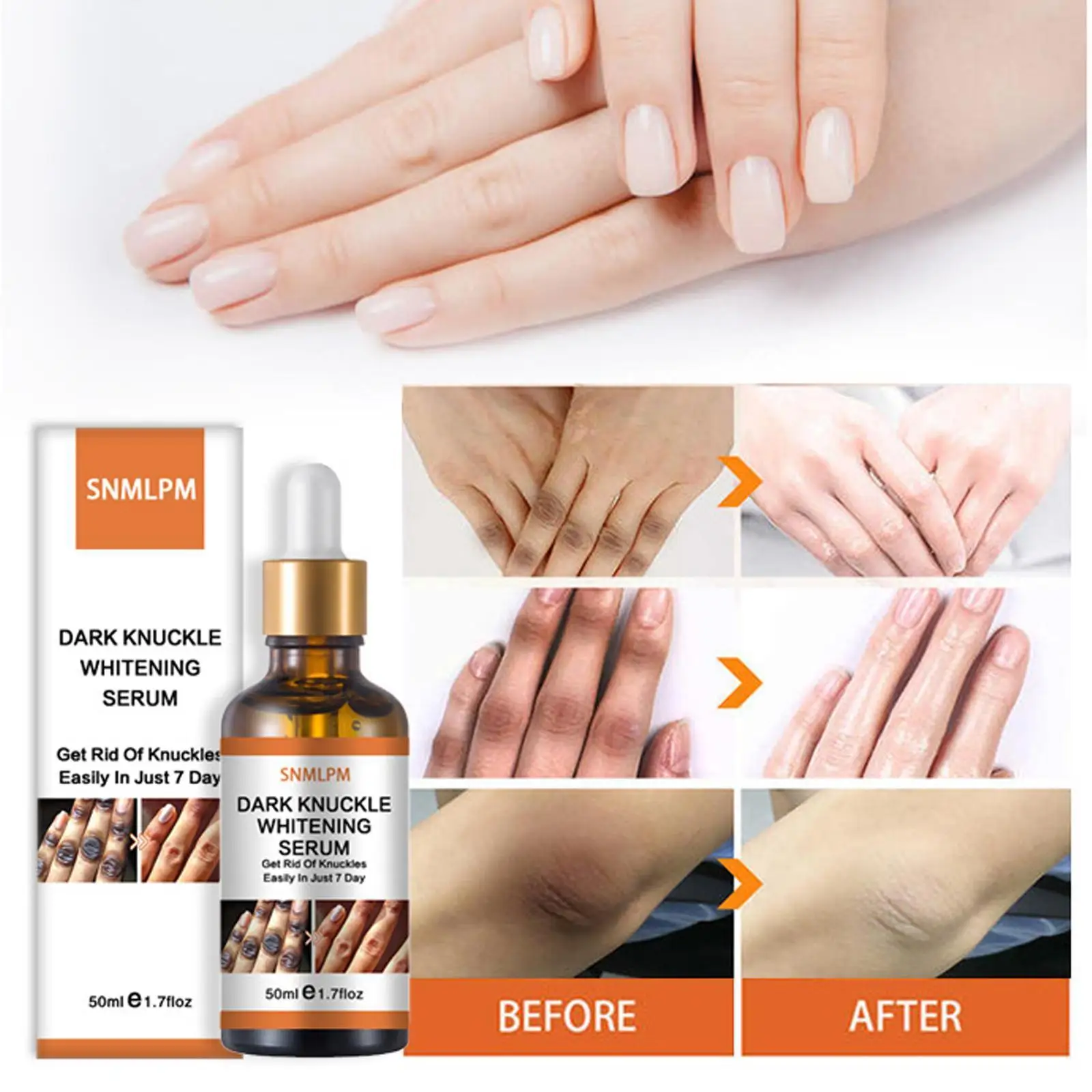Get Rid of Dark Knuckles In 7 Days Serum Whitening Removing Dark Knuckles Serum Hand Knuckle Eraser Serum for Elbow and Kne G8C2
Get Rid of Dark Knuckles In 7 Days Serum Whitening Removing Dark Knuckles Serum Hand Knuckle Eraser Serum for Elbow and Kne G8C2