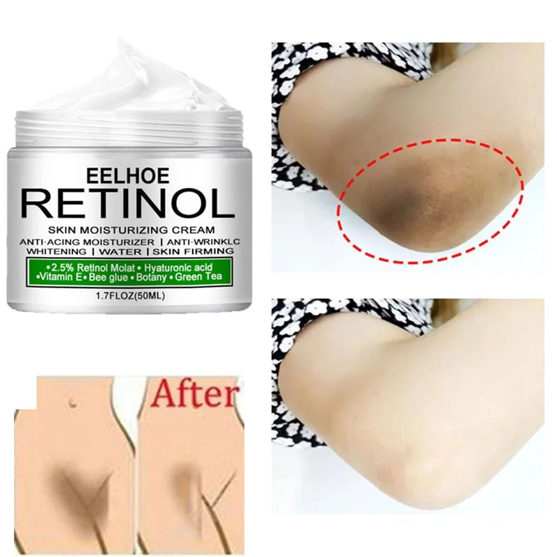 Body Whitening Cream Underarm Knee Buttocks Private Remove Pigmentation Melanin Improve Body Dull Moisturizer Brighten Skin Care
Body Whitening Cream Underarm Knee Buttocks Private Remove Pigmentation Melanin Improve Body Dull Moisturizer Brighten Skin Care
