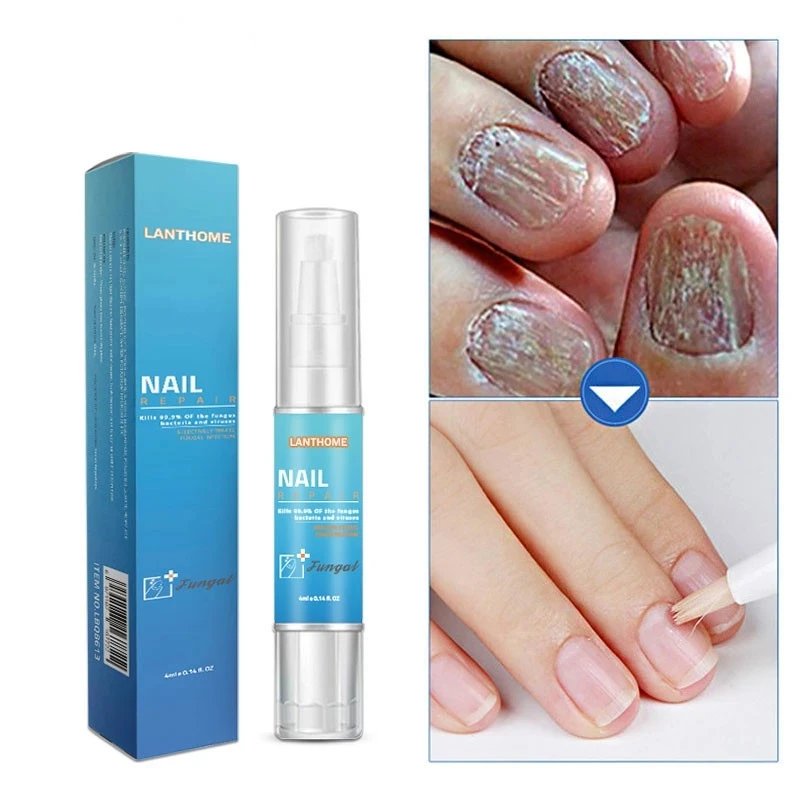Sdotter Nail Fungu лечебная сыворотка жидкость с щеткой Уход за ногтями ручка против грибка лак для ногтей масло противогрибковые капли Re
Sdotter Nail Fungu лечебная сыворотка жидкость с щеткой Уход за ногтями ручка против грибка лак для ногтей масло противогрибковые капли Re