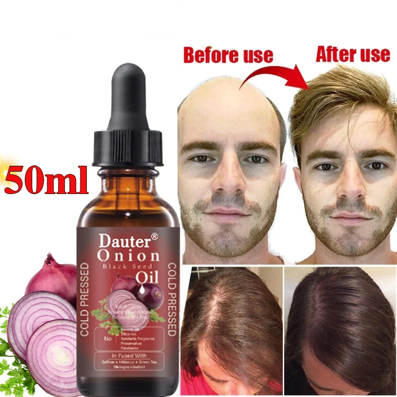 Hair growth essential oil anti hair loss prevention hair loss essence treatment of dry curly damaged hair thin nourishing care
Hair growth essential oil anti hair loss prevention hair loss essence treatment of dry curly damaged hair thin nourishing care