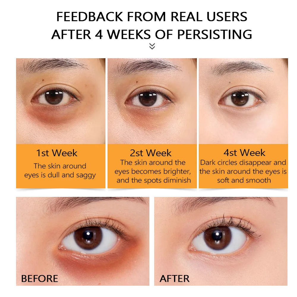 Vitamin VC Eye Essence 20ml Replenish Water Moisturize Brighten Skin Moisturize Tighten Wrinkle Anti-aging and Remove Acne
Vitamin VC Eye Essence 20ml Replenish Water Moisturize Brighten Skin Moisturize Tighten Wrinkle Anti-aging and Remove Acne