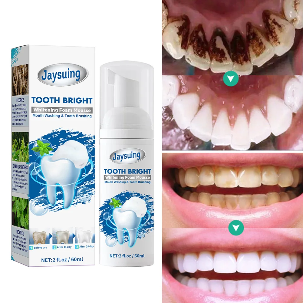 60ml Tooth Whitening Mousse Toothpaste Stains Plaque Removal Teeth Cleansing Foam Mousse Fresh Breath Oral Cavity Care
60ml Tooth Whitening Mousse Toothpaste Stains Plaque Removal Teeth Cleansing Foam Mousse Fresh Breath Oral Cavity Care