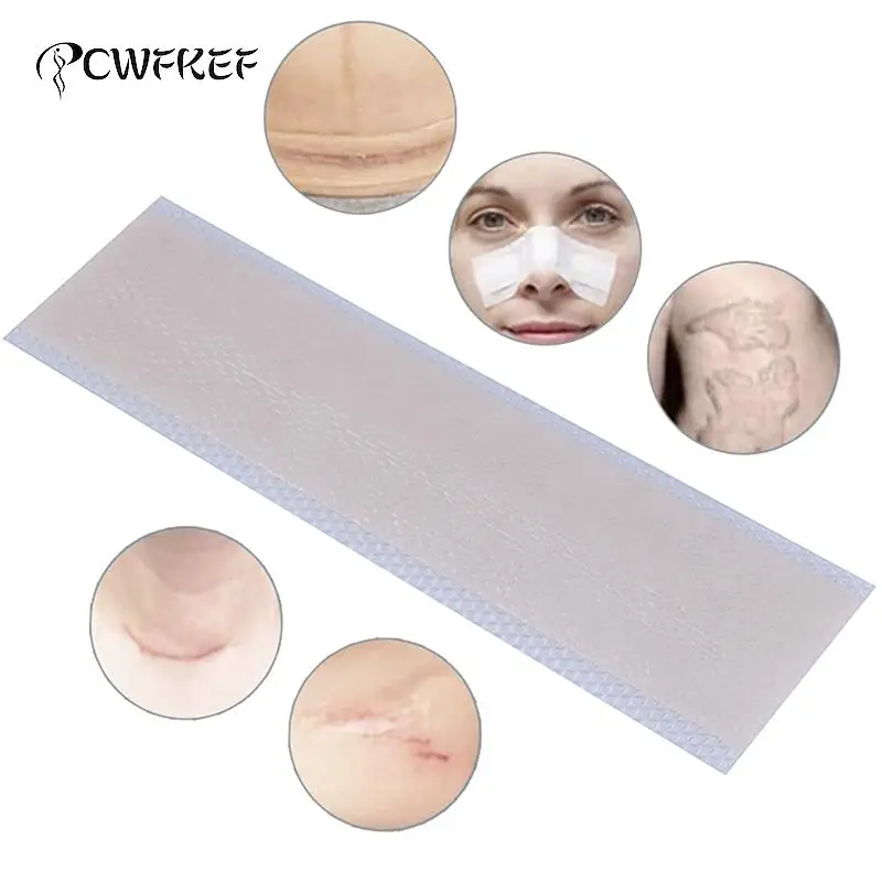 

7 стилей силиконовая гелевая пластина шрам от патч для удаления раны Знаки кесарево сечение келоидные шрамы кожи терапии