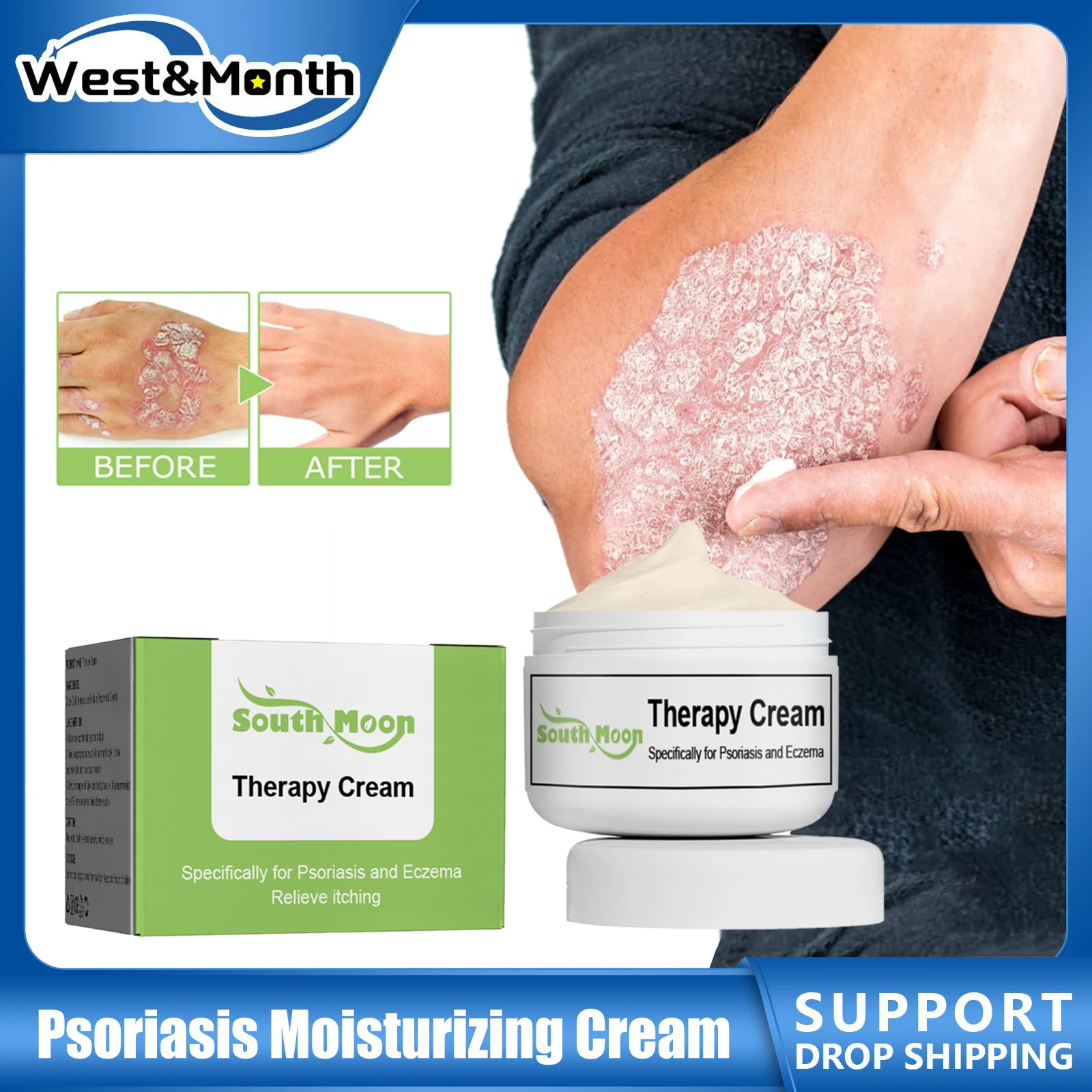 

Psoriasis Treatment Cream Eczema Relief Antibacterial Dermatitis Anti Itch Urticaria Hand Tinea Foot Inhibit Fungus Ointment 20g