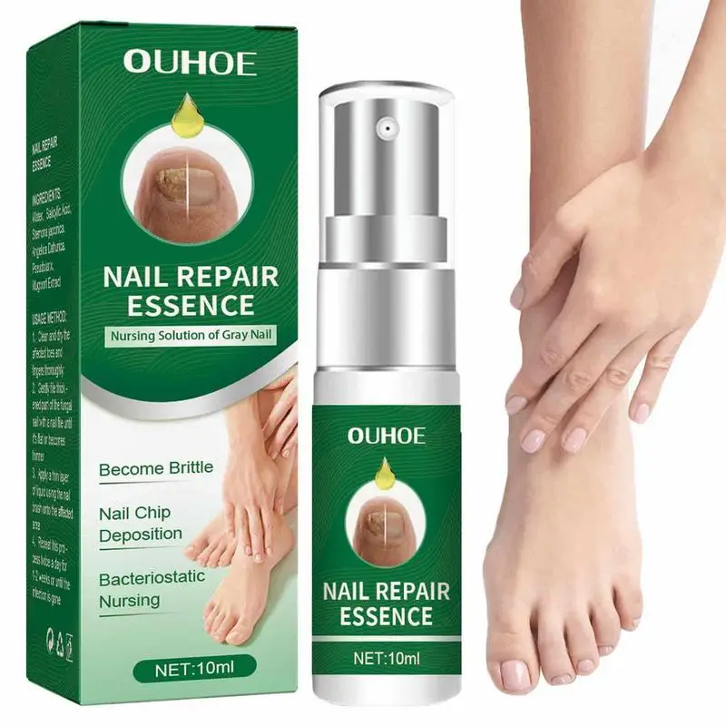 Эссенция для восстановления ногтей, эссенция для пальцев и ногтей, безопасная эссенция для восстановления поврежденных ногтей, 10 мл
Эссенция для восстановления ногтей, эссенция для пальцев и ногтей, безопасная эссенция для восстановления поврежденных ногтей, 10 мл
