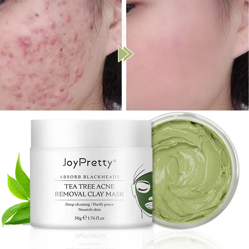 Маска JoyPretty для удаления акне с чайного дерева, глиняная маска для лица, глубокое очищение, удаление черных точек, отбеливание, увлажнение, к...
Маска JoyPretty для удаления акне с чайного дерева, глиняная маска для лица, глубокое очищение, удаление черных точек, отбеливание, увлажнение, к...