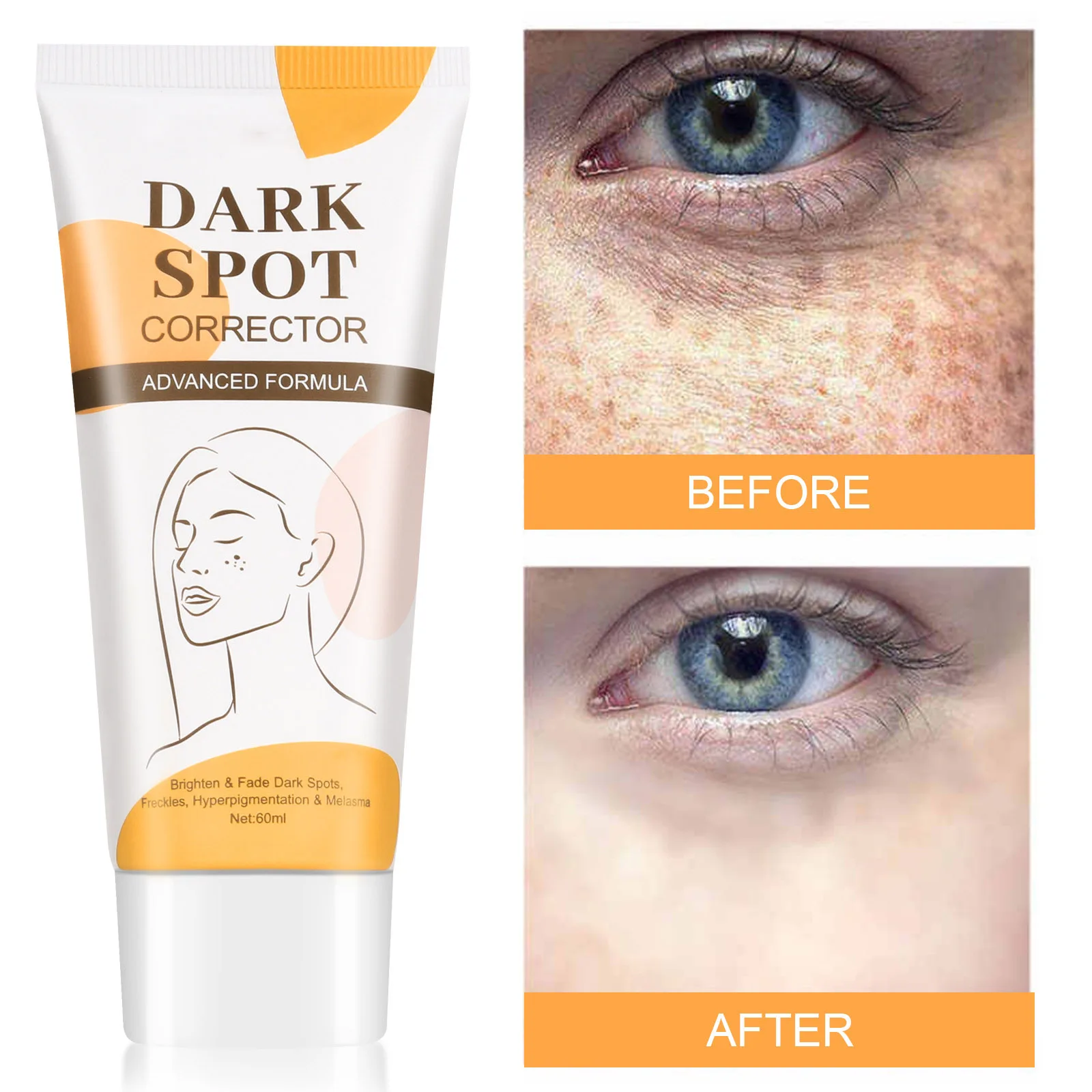 Spot Remover Cream Moisturizing Face Brightens Skin Anti-aging Anti-Wrinkle Essence Facial Skin Lifting Cream Skin Care
Spot Remover Cream Moisturizing Face Brightens Skin Anti-aging Anti-Wrinkle Essence Facial Skin Lifting Cream Skin Care