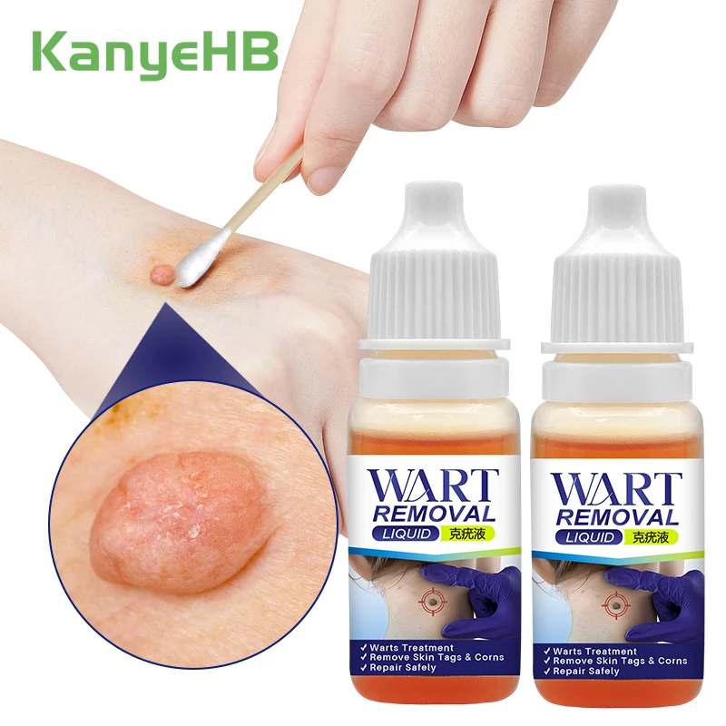2Pcs Skin Warts Removal Liquid Antibacterial Treatment Papillomas Remove Flat Warts Genital Warts Herbal Medical Liquid A1491
2Pcs Skin Warts Removal Liquid Antibacterial Treatment Papillomas Remove Flat Warts Genital Warts Herbal Medical Liquid A1491