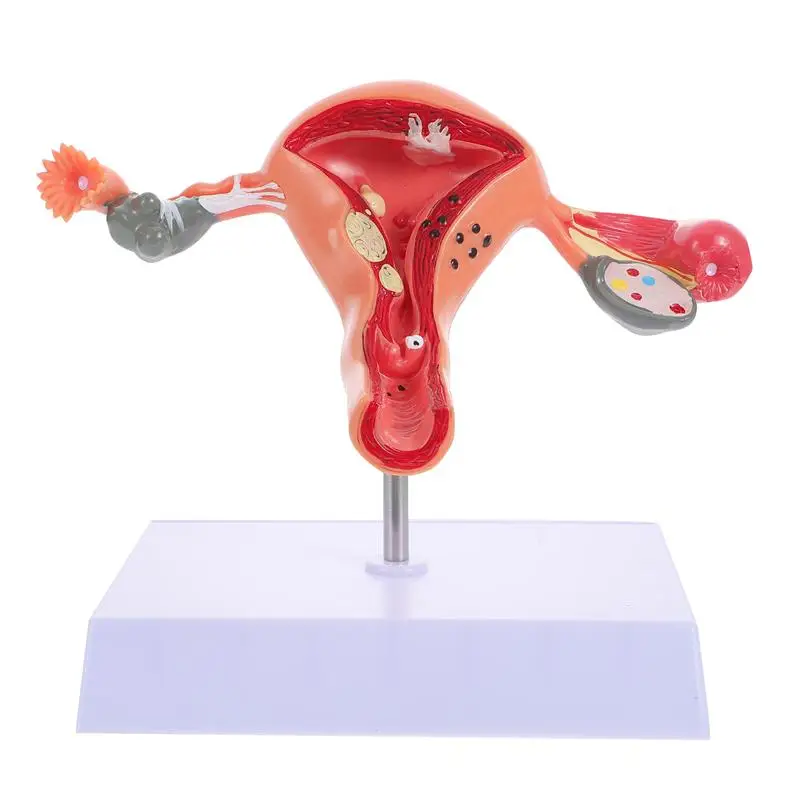1Pc Practical Uterus Model Female Reproductive System Model for Medical Training
1Pc Practical Uterus Model Female Reproductive System Model for Medical Training