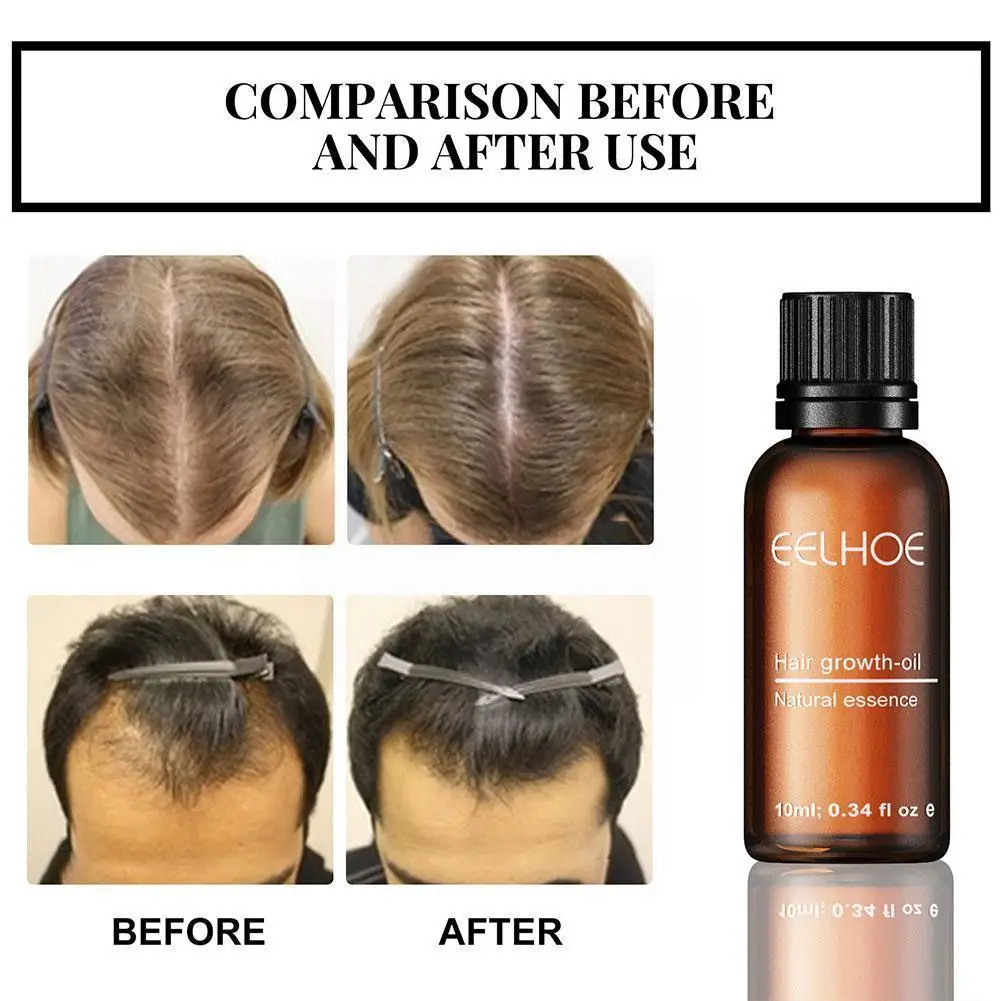 Hair Growth Products Ginger Essence Fast Regrowth Serum Beard Growth Oil Hair Loss Care Beauty Scalp Treatment For Men Wome M2p2
Hair Growth Products Ginger Essence Fast Regrowth Serum Beard Growth Oil Hair Loss Care Beauty Scalp Treatment For Men Wome M2p2