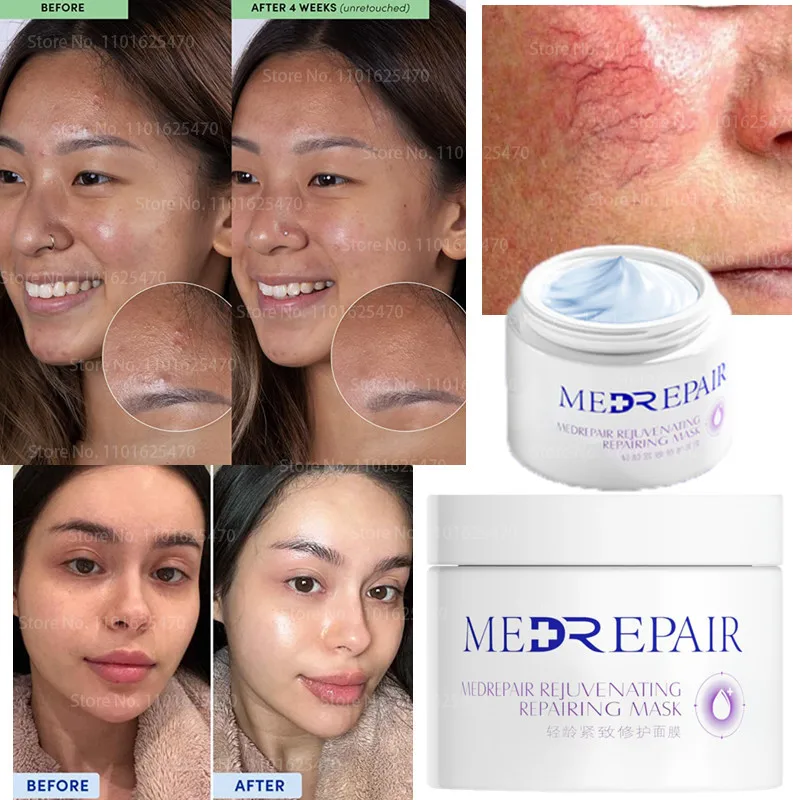 Intense Hydrating Mask Reduces Redness and Wrinkles Improves Skin Texture Anti-Aging Whitening Hydrating Mask for Sensitive Skin
Intense Hydrating Mask Reduces Redness and Wrinkles Improves Skin Texture Anti-Aging Whitening Hydrating Mask for Sensitive Skin