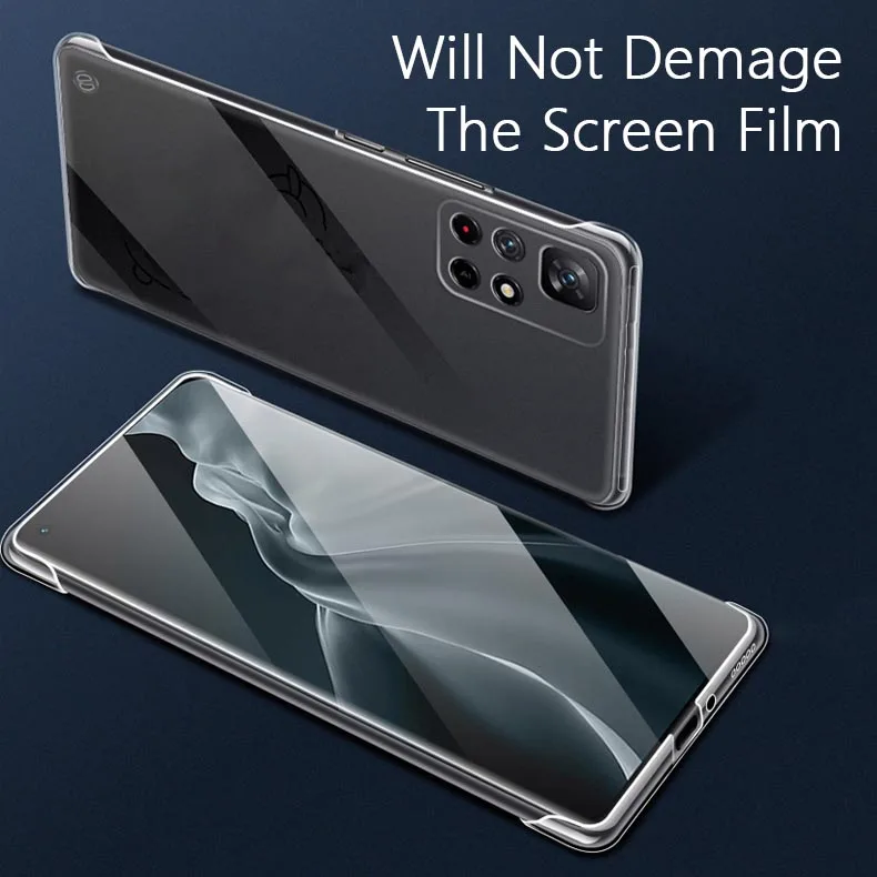 2Pcs Clear Ultra Thin Frameless Phone Case For Xiaomi Redmi Note 11 Pro Plus Transparent PC Back Camera Protector Shell DIY
2Pcs Clear Ultra Thin Frameless Phone Case For Xiaomi Redmi Note 11 Pro Plus Transparent PC Back Camera Protector Shell DIY