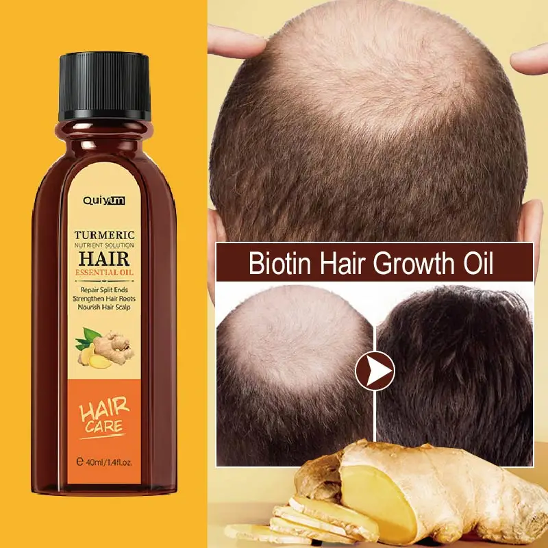 Fast Regrowth Anti-Hair Loss Serum Hair Growth Turmeric Hair Care Oil Prevent Baldness Dry Damaged Beard Scalp Treatment Essence
Fast Regrowth Anti-Hair Loss Serum Hair Growth Turmeric Hair Care Oil Prevent Baldness Dry Damaged Beard Scalp Treatment Essence