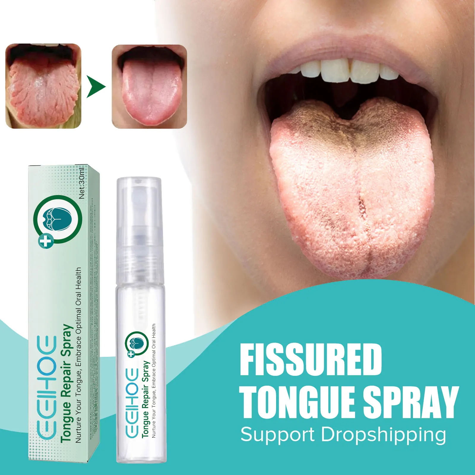 Tongue Cracking Relief Spray Portable Bad Breath Cleaning Dirt Fissured Tongue Pain Repair Bleeding Freshening Mouth Liquid 30ml
Tongue Cracking Relief Spray Portable Bad Breath Cleaning Dirt Fissured Tongue Pain Repair Bleeding Freshening Mouth Liquid 30ml