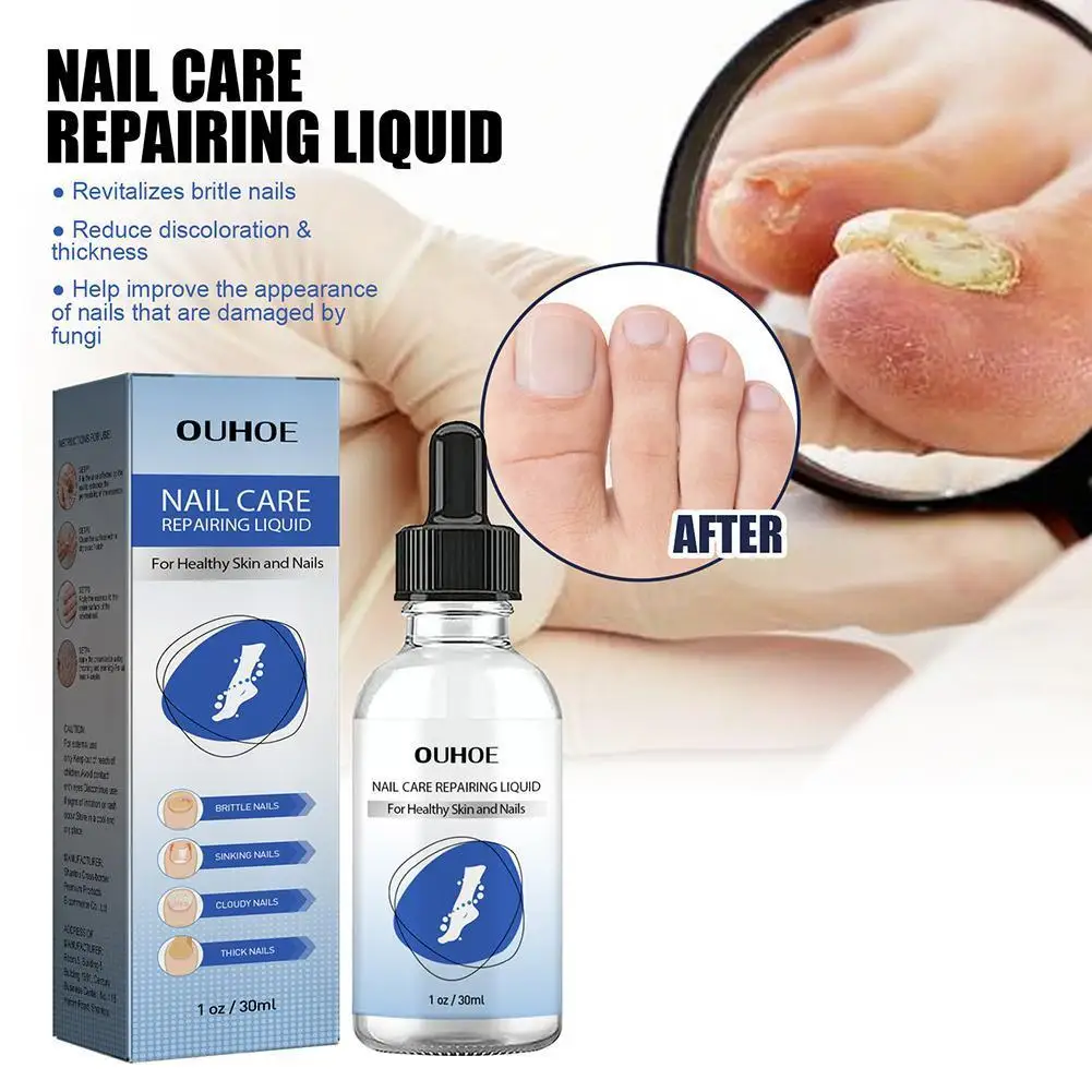 30ml Nail Care Repairing Liquid Promote Nail Growth Splits Cracks Anti Chips Nail Infection Treatment Peeling Nails Stop Es D4Z2
30ml Nail Care Repairing Liquid Promote Nail Growth Splits Cracks Anti Chips Nail Infection Treatment Peeling Nails Stop Es D4Z2